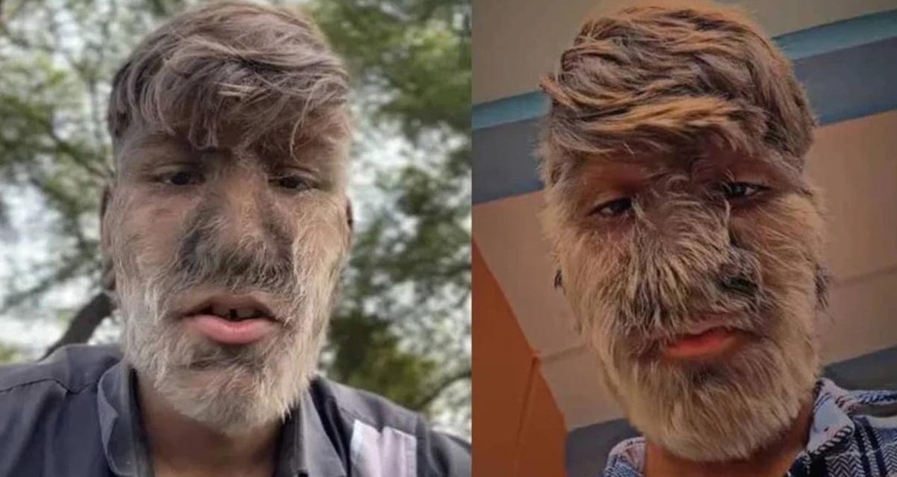 Dünyanın en kıllı insanı! Rekorlar kitabına girdi